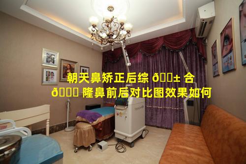 朝天鼻矫正后综 🐱 合 🐛 隆鼻前后对比图效果如何